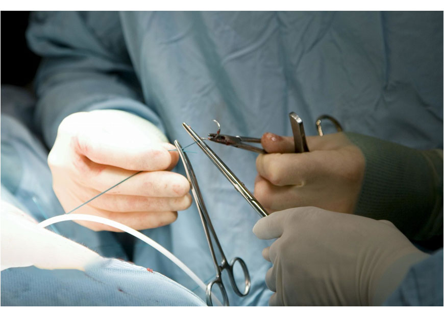 Surgical Suture Thread
