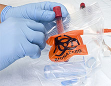 تغليف عينات لـ النقل: Biohazard أكياس العينات